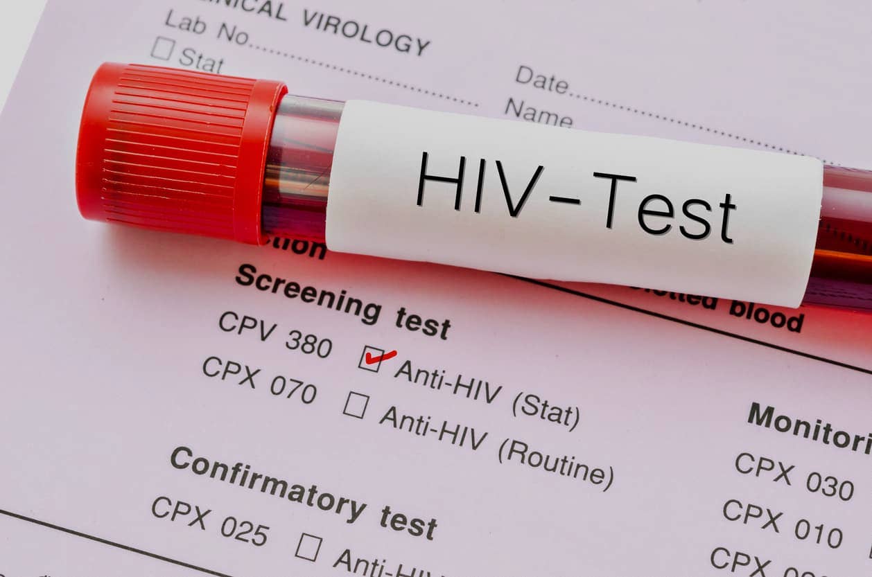 HIV Testing Singapore: Can it Give Wrong Results?