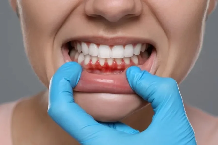 How General Dentistry Supports Long-Term Gum And Bone Health