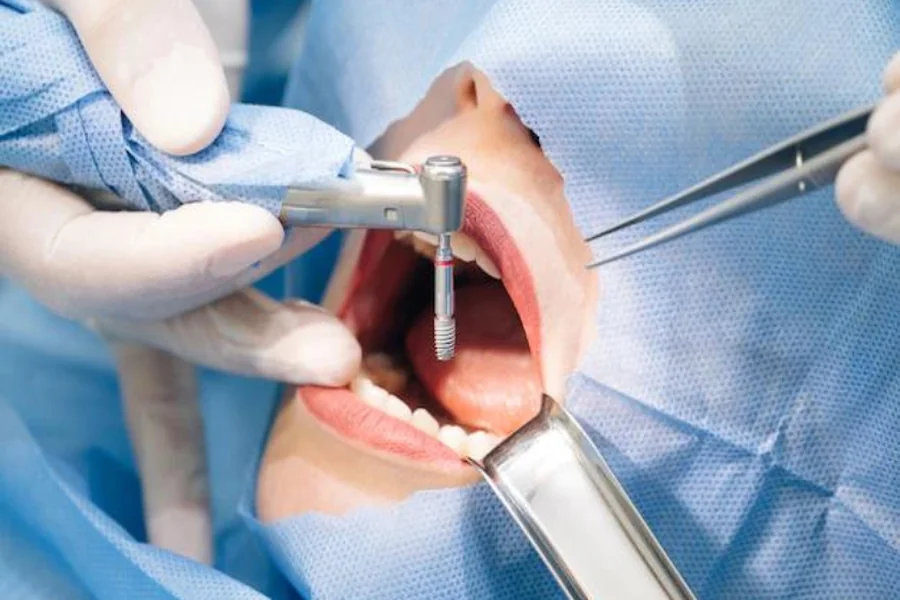 Dental Implant