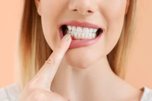 Cosmetic Gum