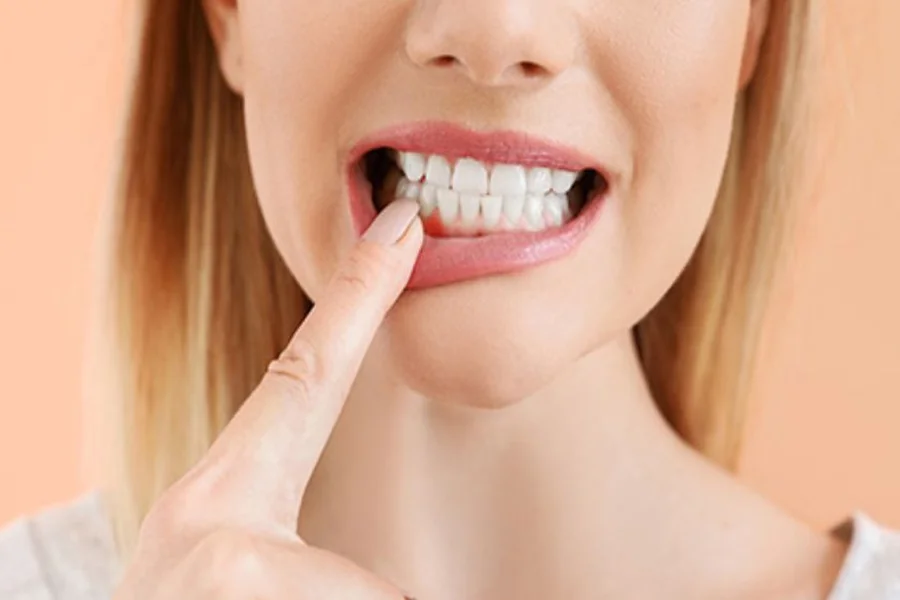 Cosmetic Gum