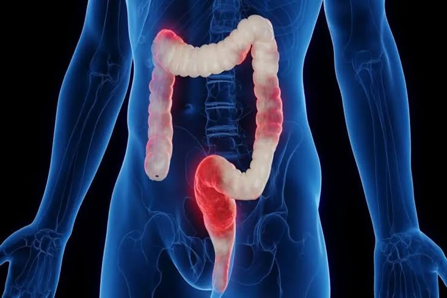 How A Colon Specialist Singapore Can Help With Unexplained Rectal Bleeding